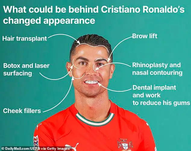 بوتوكس وحقن دهون.. رقم مرعب لعدد عمليات التجميل التي أجراها رونالدو/صور