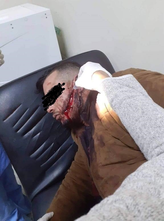 بعد آدم بوليفة : هكذا كان مصير حريف اثر مواجهة مع حرّاس ملهى ليلي بالحمّامات