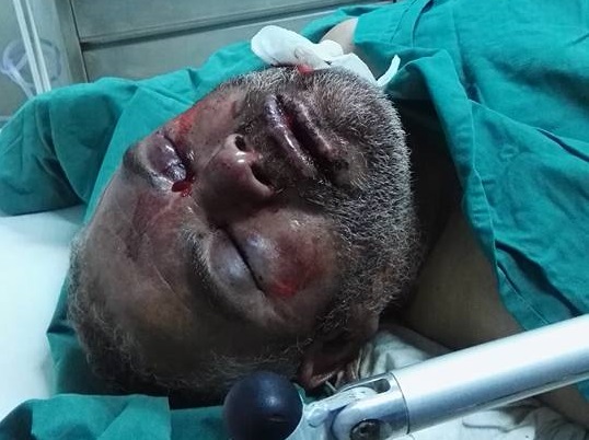 خطير في جامع الزهراء : طلب منه مغادرة الجامع بعد صلاة الصبح ، فأحاله على الإنعاش !