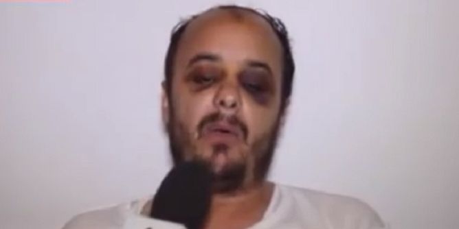 أستاذ ثانوي يؤكد تعرضه لمحاولة قتل من طرف عون أمن بزي مدني