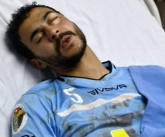 المدافع السابق للنجم الساحلي شهاب بن فرج يتعرّض لإصابة خطيرة على مستوى الوجه
