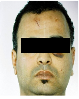 إيطاليا : مهاجر تونسي يقتل مغربيا في جلسة تعاطي المخدرات 