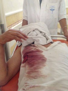 القيروان : اصابة 9 أشخاص في مواجهات بين عرشين ببنادق صيد