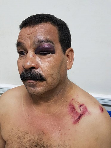 في مباراة كرة الماء بين الإفريقي والمرسى : مسبح المنزه يتحوّل إلى حلبة ملاكمة