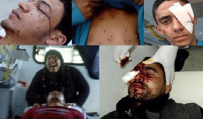 هيئة الدفاع عن ضحايا الرش بسليانة تعلن رفعها قضية ضد الدولة