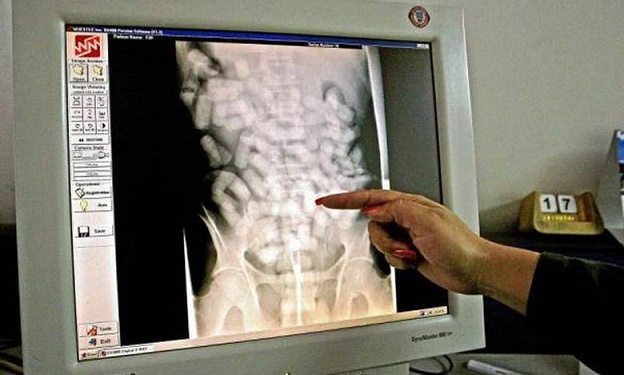 مطار قرطاج : القبض على مهرّب خطير للمخدرات تعمّد ابتلاع ربع كيلو من الهيروين