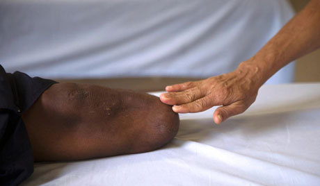 يبتر ساقه بنفسه لعجزه عن سداد ثمن العلاج
