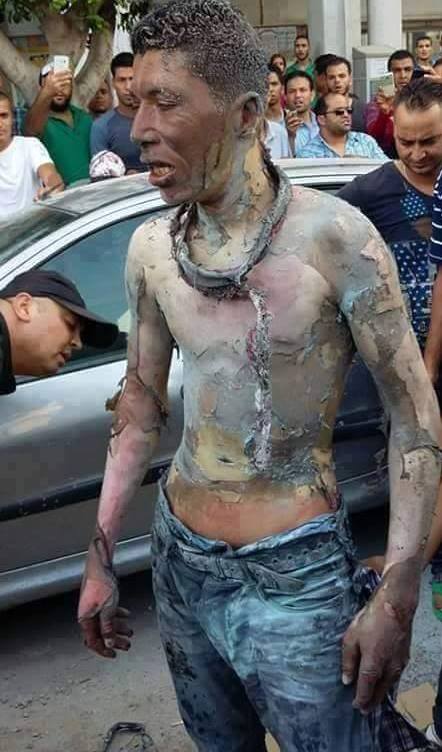 وفاة الشابّ الذي أضرم النّار في جسده أمام مقرّ ولاية صفاقس