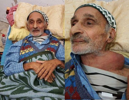يحدث في تونس : شيخ يصارع الموت ...والدولة تنتزع منه منحة الفقر !!