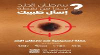 إطلاق