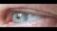 (فيديو ) تطوير جهاز مجهري لعلاج السكري يزرع في العين